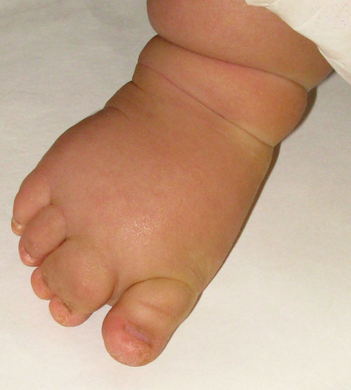small wide feet